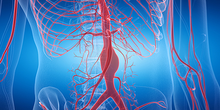 All About Aortic Aneurysms